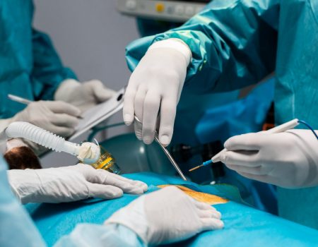 Kidney Surgery