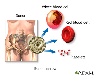 Bone Marrow
